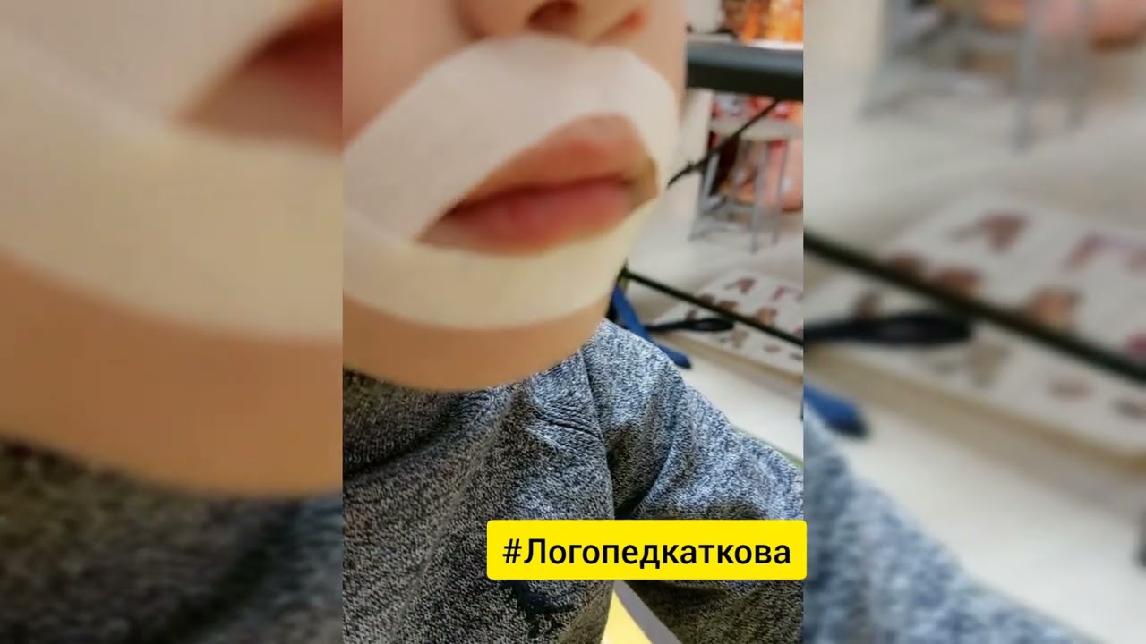 тейпы в работе логопеда и в коррекции. Хочешь применять? пиши мне 89269266587