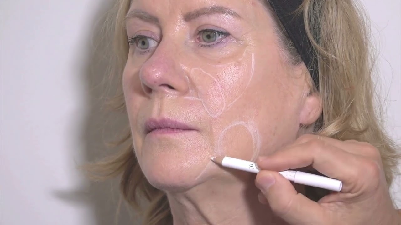 Filler per il Volto - Terzo Inferiore