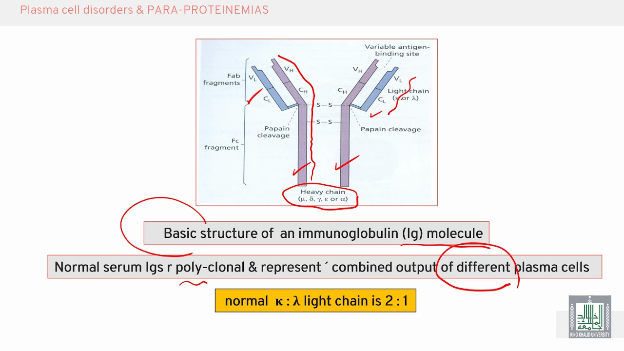 Pathology Hematology | 31 |  Plasma cell disorders (Paraproteinemia)
