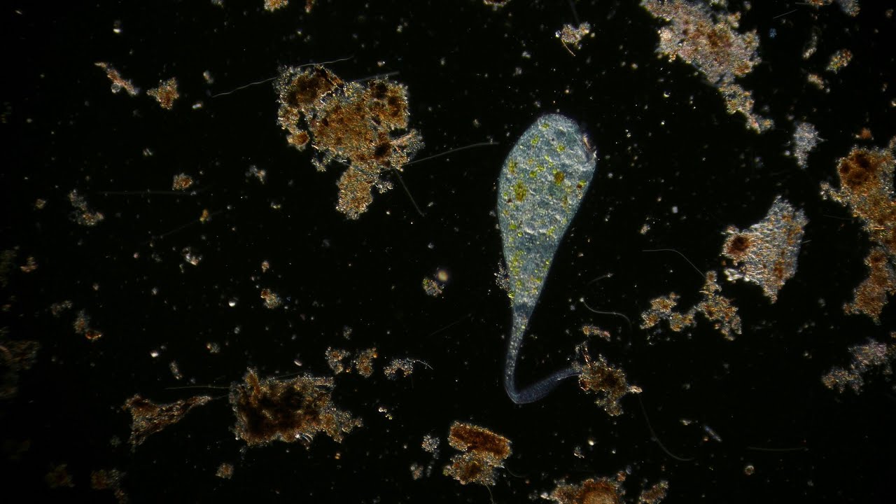 🔬 Stentor (trumpet animalcules) ciliate - microorganism - life in pond water under microscope 4K