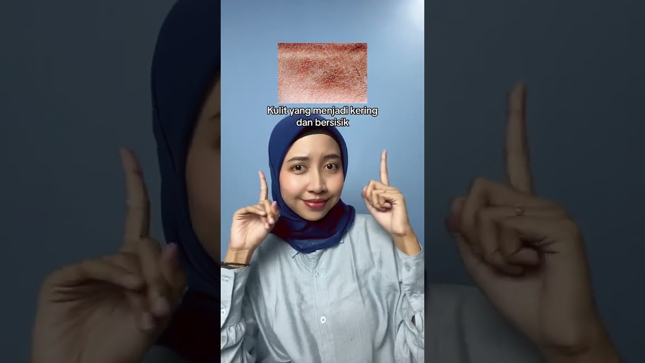 Ciri Kulit Gatal Karena Eksim
