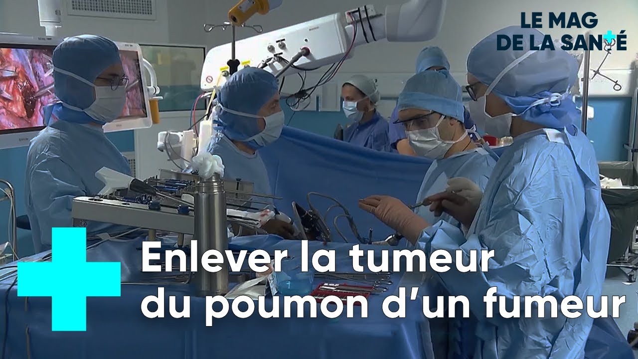 Cancer du poumon : une chirurgie de pr&eacute;cision - Le Magazine de la Sant&eacute;