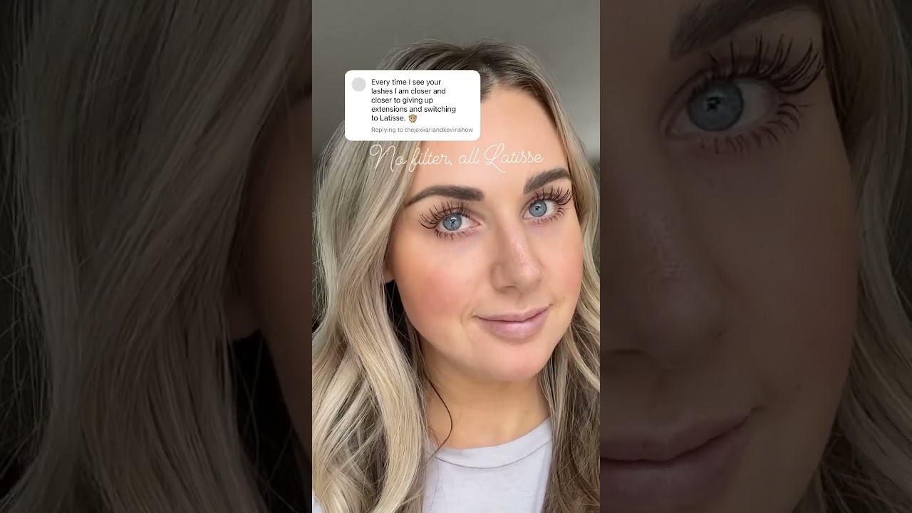 My Latisse eyelash growth serum results 🥰 I use 4x a week! #latisse #girltips #lashesfordays