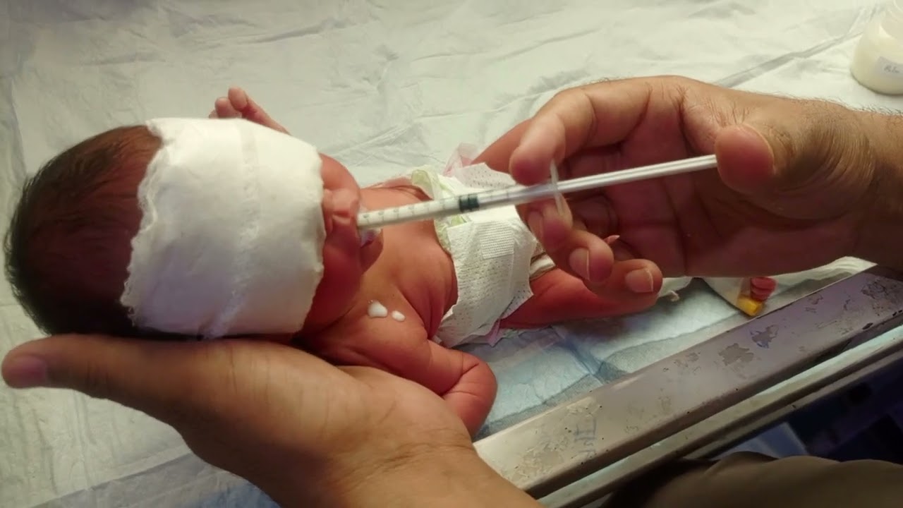 Preterm Baby Feeding with Syringe |NICU Feeding Care for Premature Newborn#PretermBaby #Syringe 