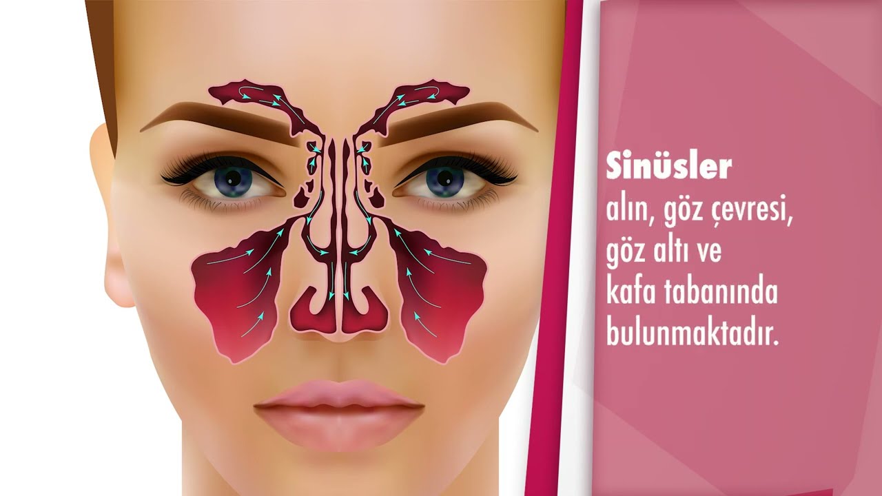 Endoskopik sinüs cerrahisi nedir? Endoskopik sinüs cerrahisi nasıl yapılır? - Doç. Dr. Ela A Server