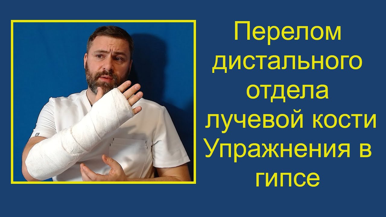 Перелом дистального отдела лучевой кости. Упражнения в гипсе.