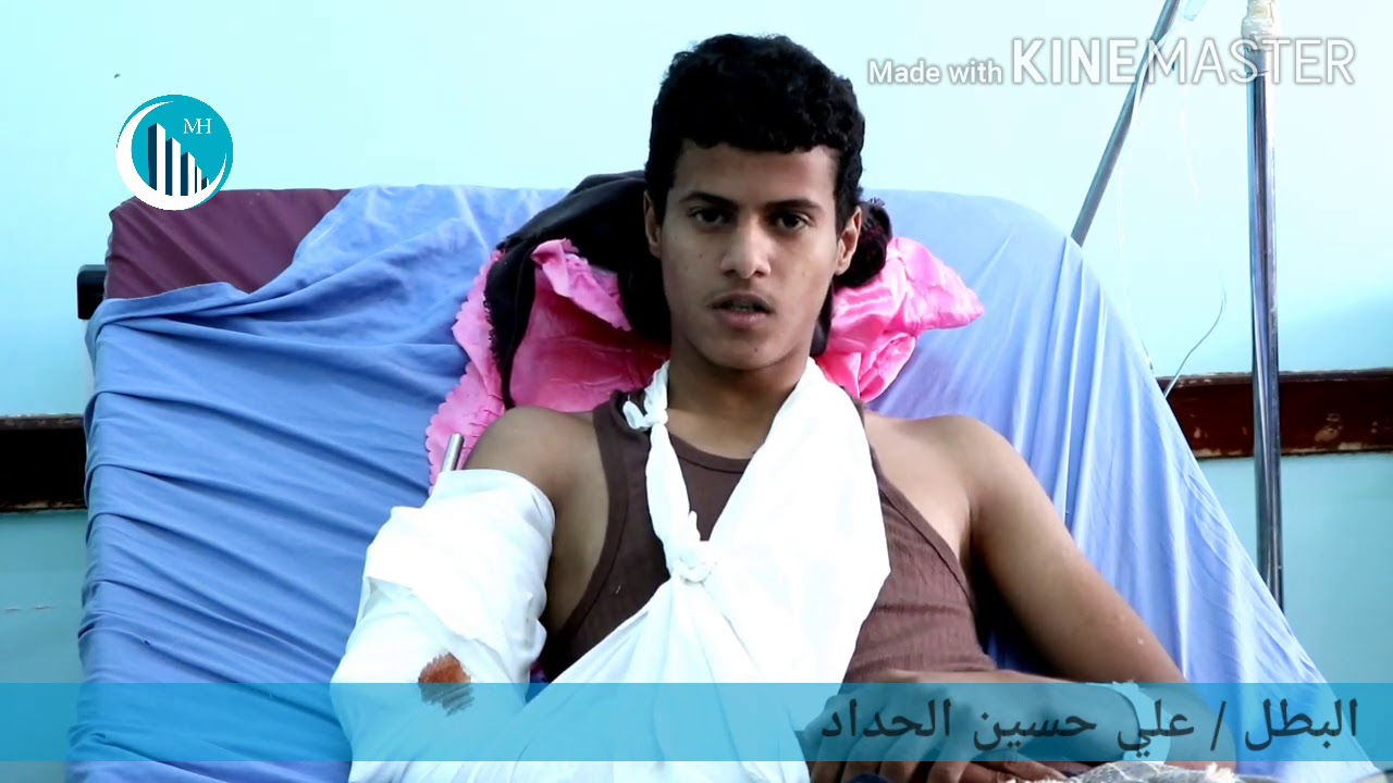 شاهد ماذا قال الجريح علي الحداد عن هيئة مستشفى مأرب وعن معنوياته