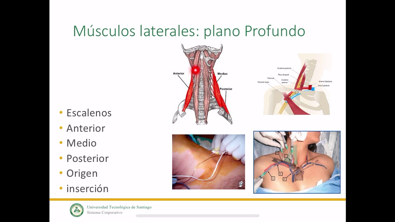 Músculos del cuello