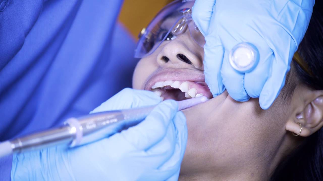 Nupro Revolv Slim Disposable Prophy Angles | Dentsply Sirona