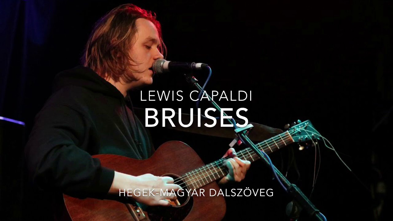 Lewis Capaldi-Bruises (Magyar dalszöveg)