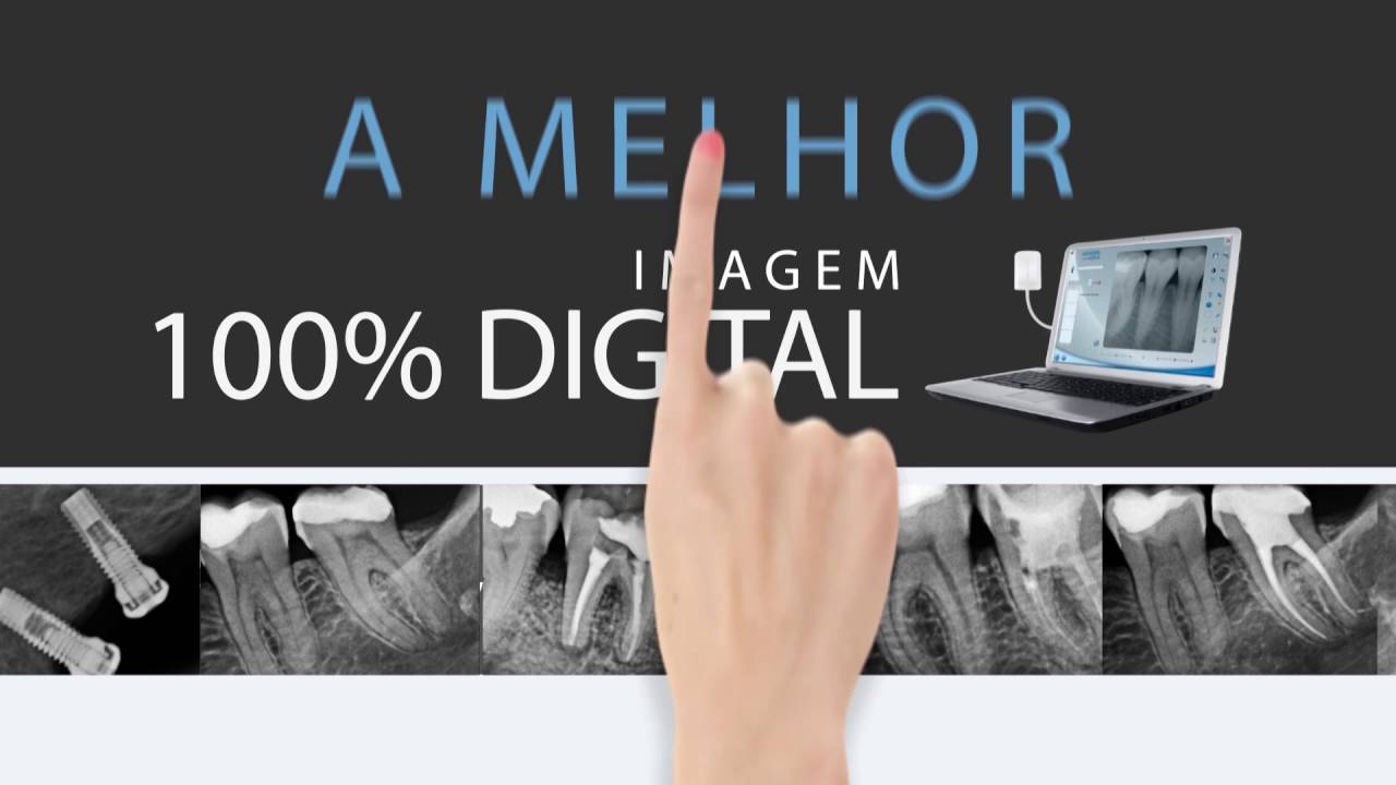 New IDA - Sensor Intraoral