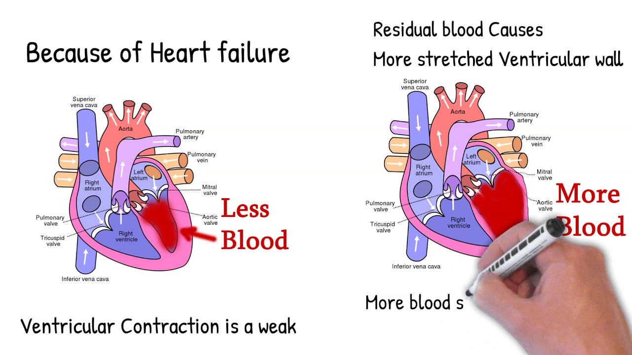 Pulsus alternans &mdash; чередование одного сильного и одного слабого удара.