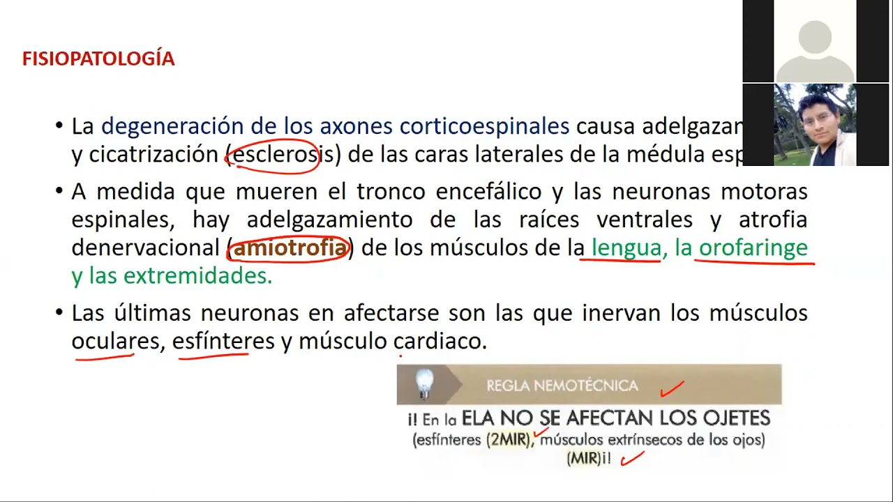 ESCLEROSIS LATERAL AMIOTRÓFICA
