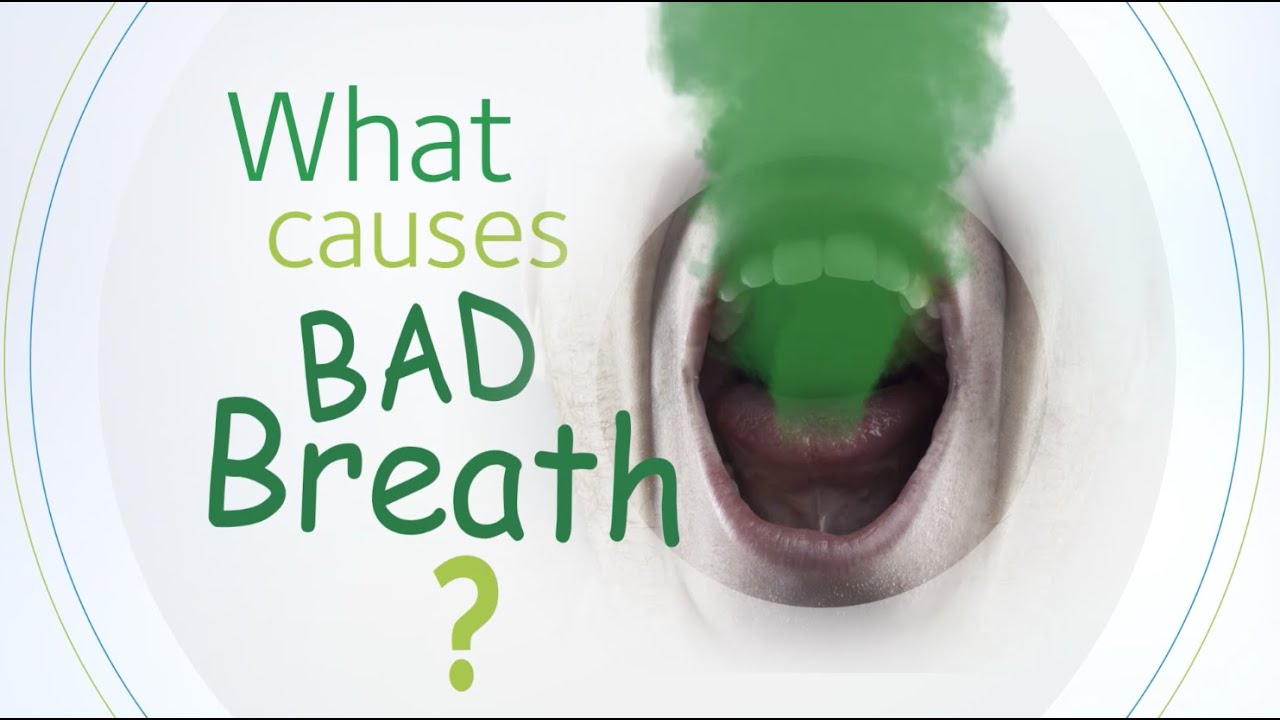 What Causes Bad Breath?