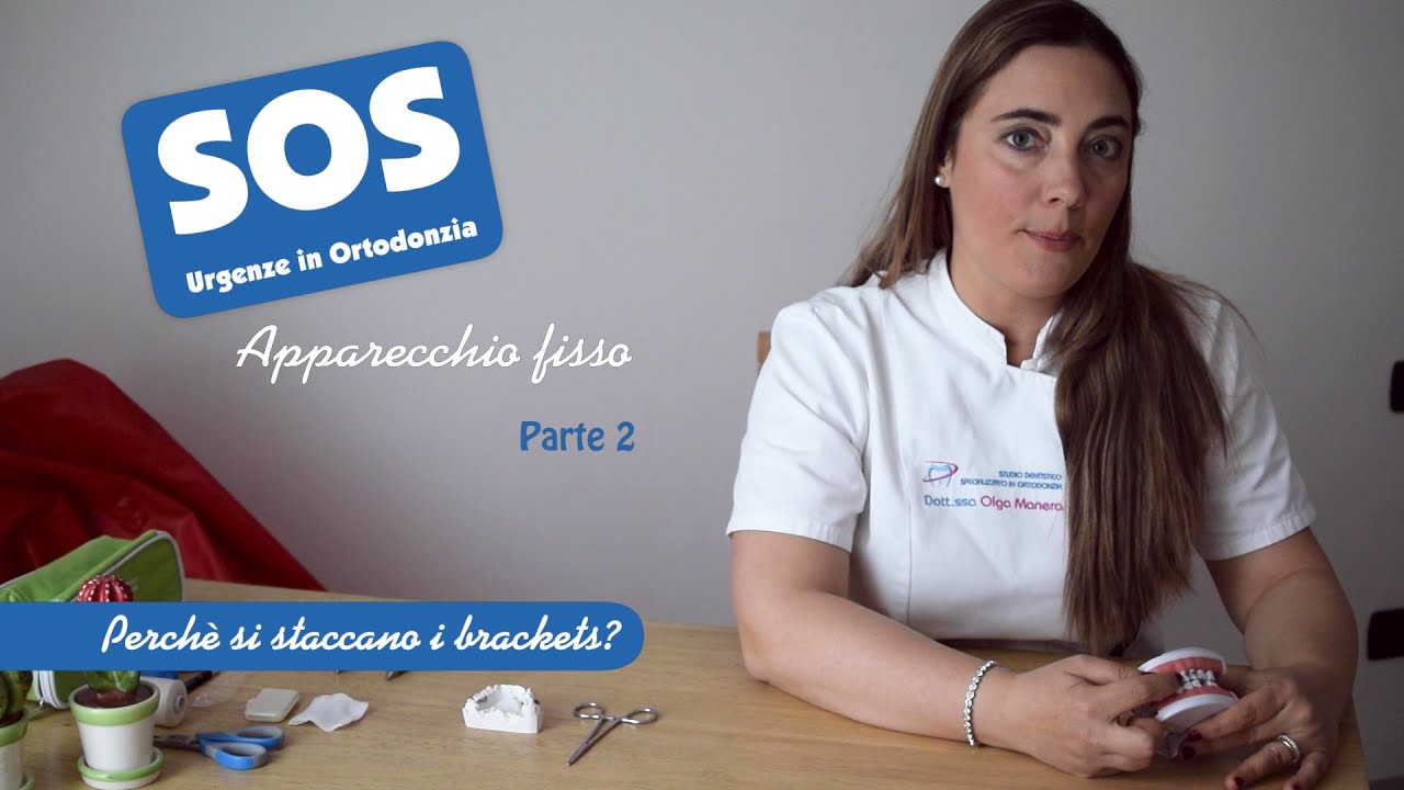 SOS Apparecchio Fisso - Perchè si staccano i brackets?