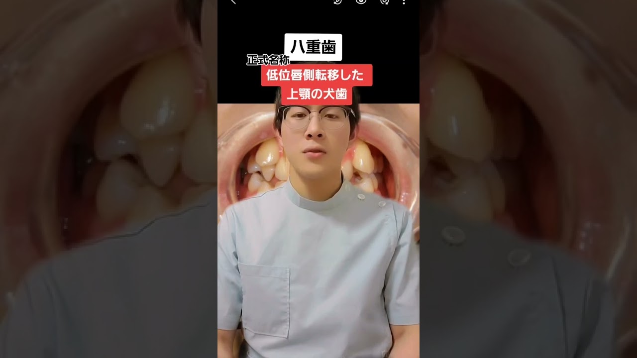 【雑学】八重歯について解説します#Shorts