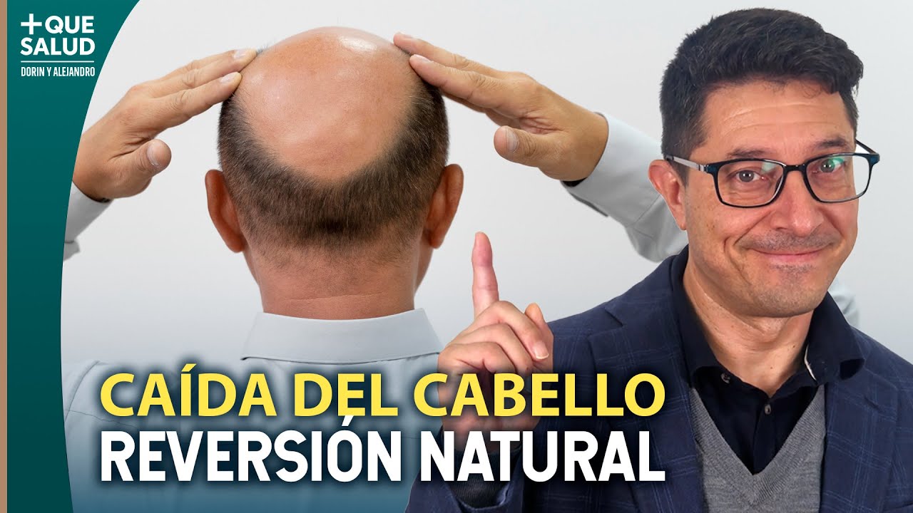 Cómo revertir la pérdida de cabello