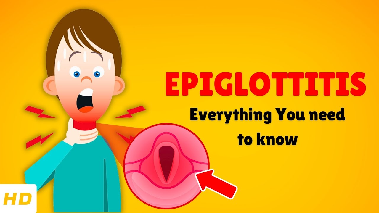 Epiglottitis – Causes, Signs and Symptoms, Diagnosis & Treatment