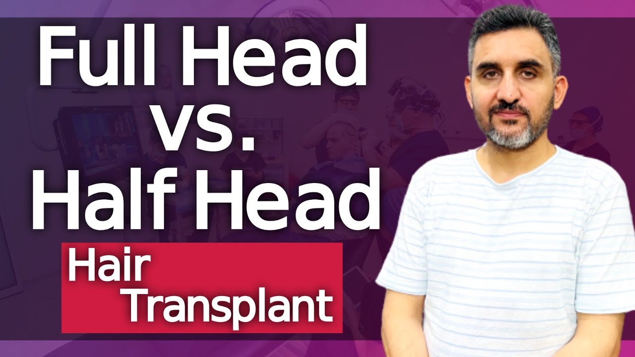 Full Head vs. Half Head Hair Transplant: Unveiling Dr. Habib's Expertise