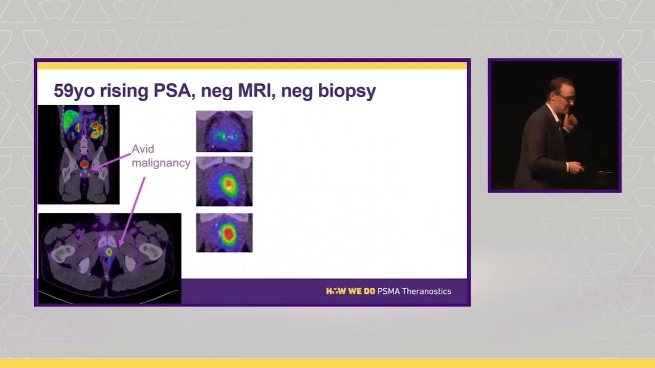 Will PSMA PET replace mpMRI for diagnosis of prostate cancer? A/Prof Daniel Moon presents #prostic22