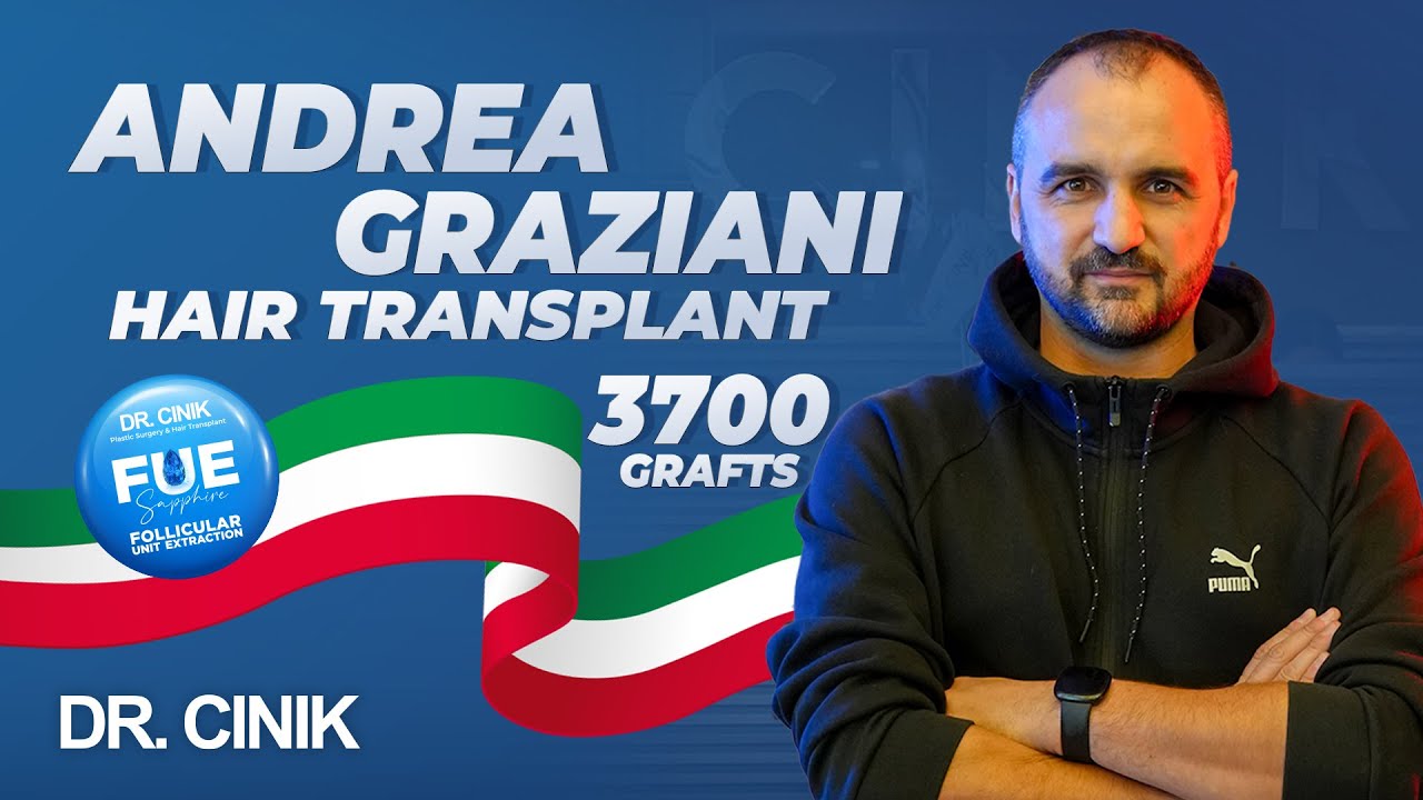 Andrea Graziani's Hair Secret Revealed: FUE at Dr. Cinik!😎