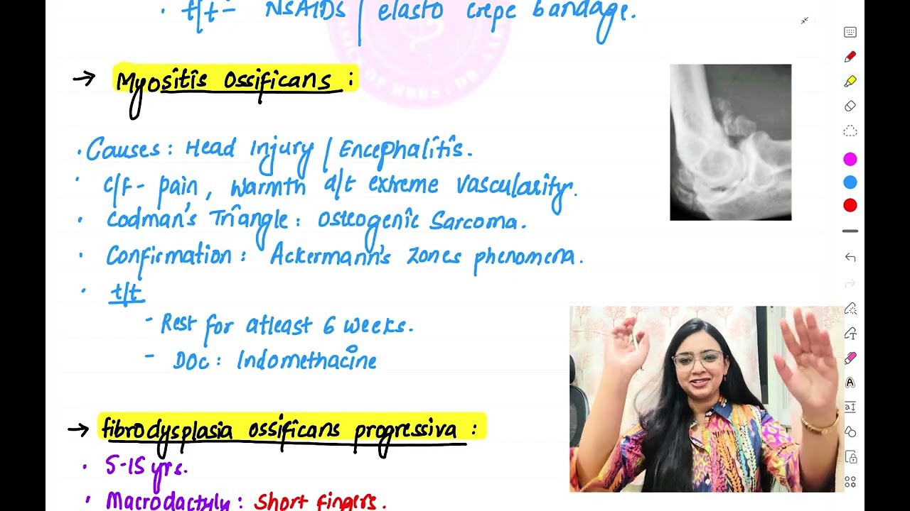 Orthopaedics Part 2 | FMGE | NEET PG