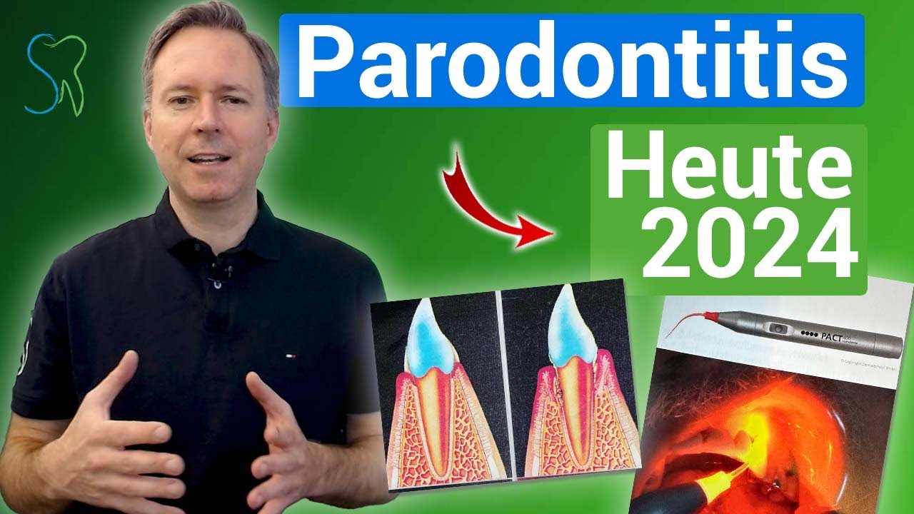 Parodontitis heute im Jahr 2024, Erkenntnisse und Therapien