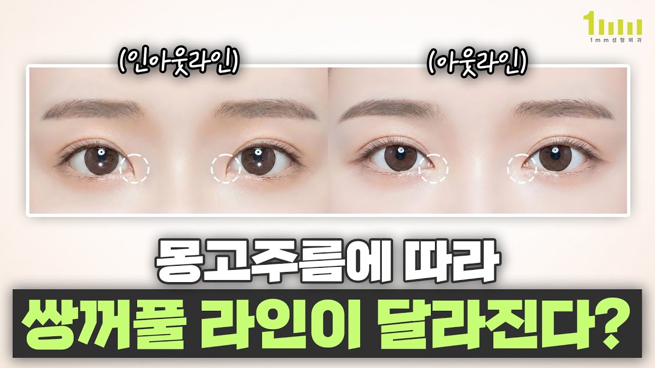 몽고주름에 따라 쌍꺼풀 라인이 달라진다고? 팩트체크✅해 볼게요!