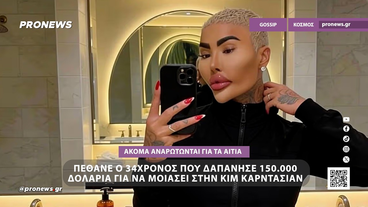 Πέθανε ο 34χρονος που δαπάνησε 150.000 δολάρια για να μοιάσει στην Κιμ Καρντάσιαν