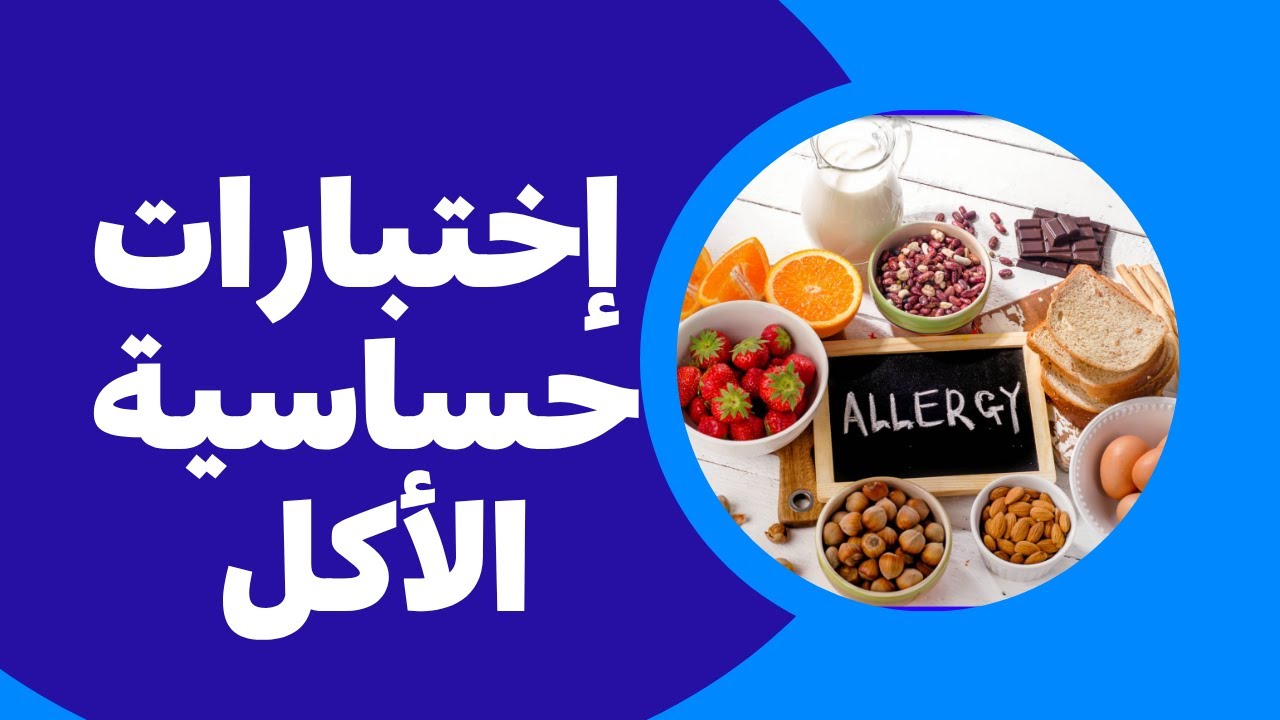 Food allergy tests | حساسية الطعام | الاعراض | الاسباب | التحاليل | اشهر الاكلات