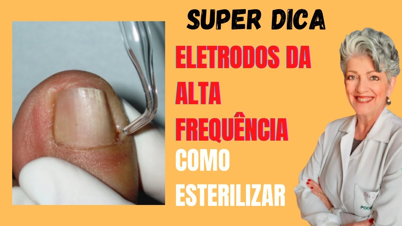 Como Esterilizar os Eletrodos da Alta Frequência