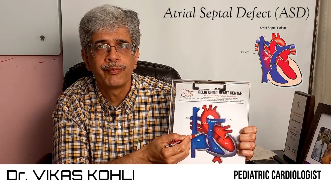 ATRIAL SEPTAL DEFECT (ASD) || DR. Vikas Kohli || CONGENITAL HEART DEFECT (CHD)