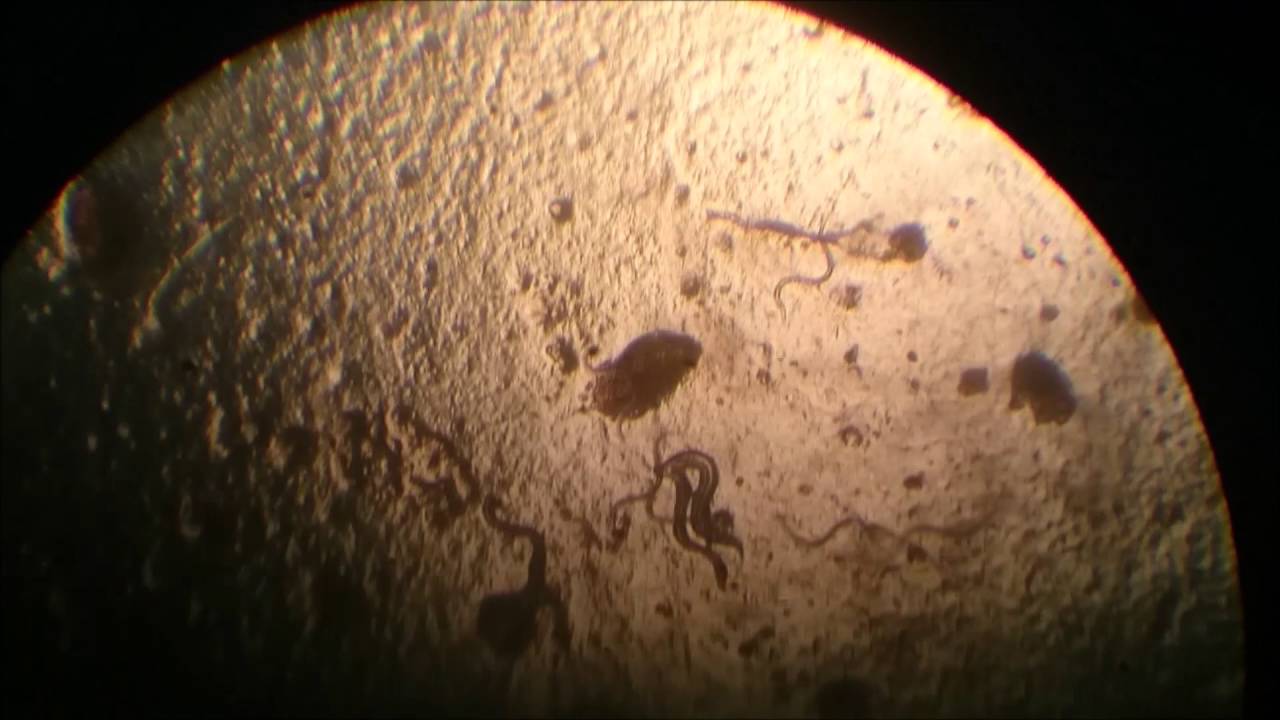Ancylostoma duodenale