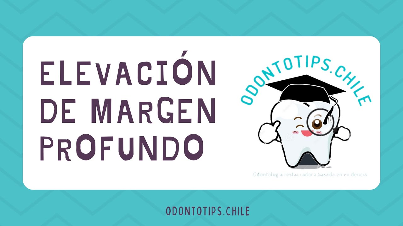 Elevaci&oacute;n de margen profundo/ reubicaci&oacute;n de margen cervical (t&eacute;cnica de matrix in a matrix) 🔥