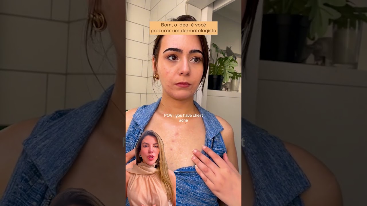 Você tem acne no colo, nas costas ou no peito e que te incomoda no dia a dia?⠀