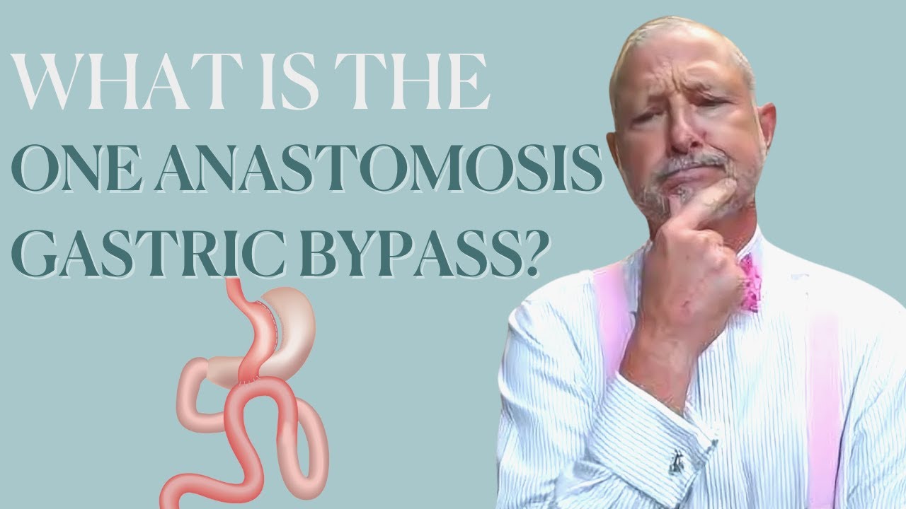 Let's Talk About the One Anastomosis Gastric Bypass (OAGB)