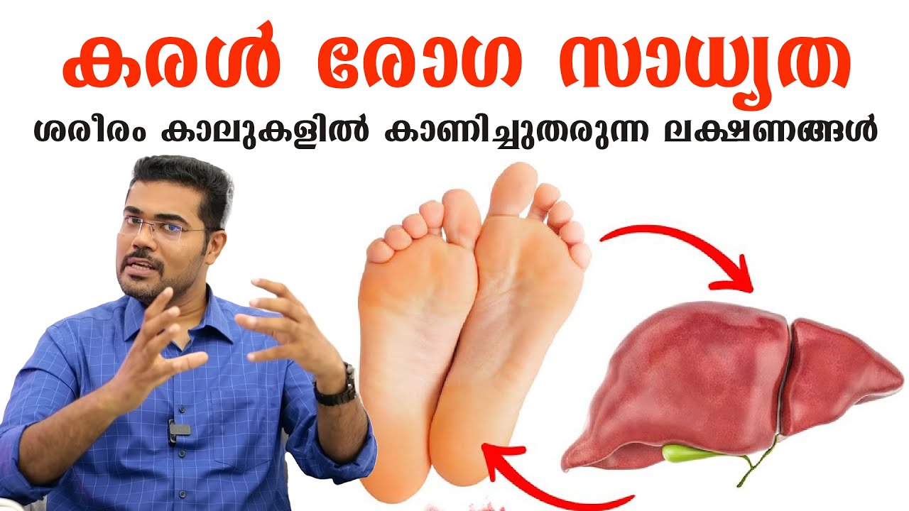 കരൾ രോഗ സാധ്യത ശരീരം കാലുകളിൽ കാണിച്ചുതരുന്ന ലക്ഷണങ്ങൾ /Dr Manoj Johnson
