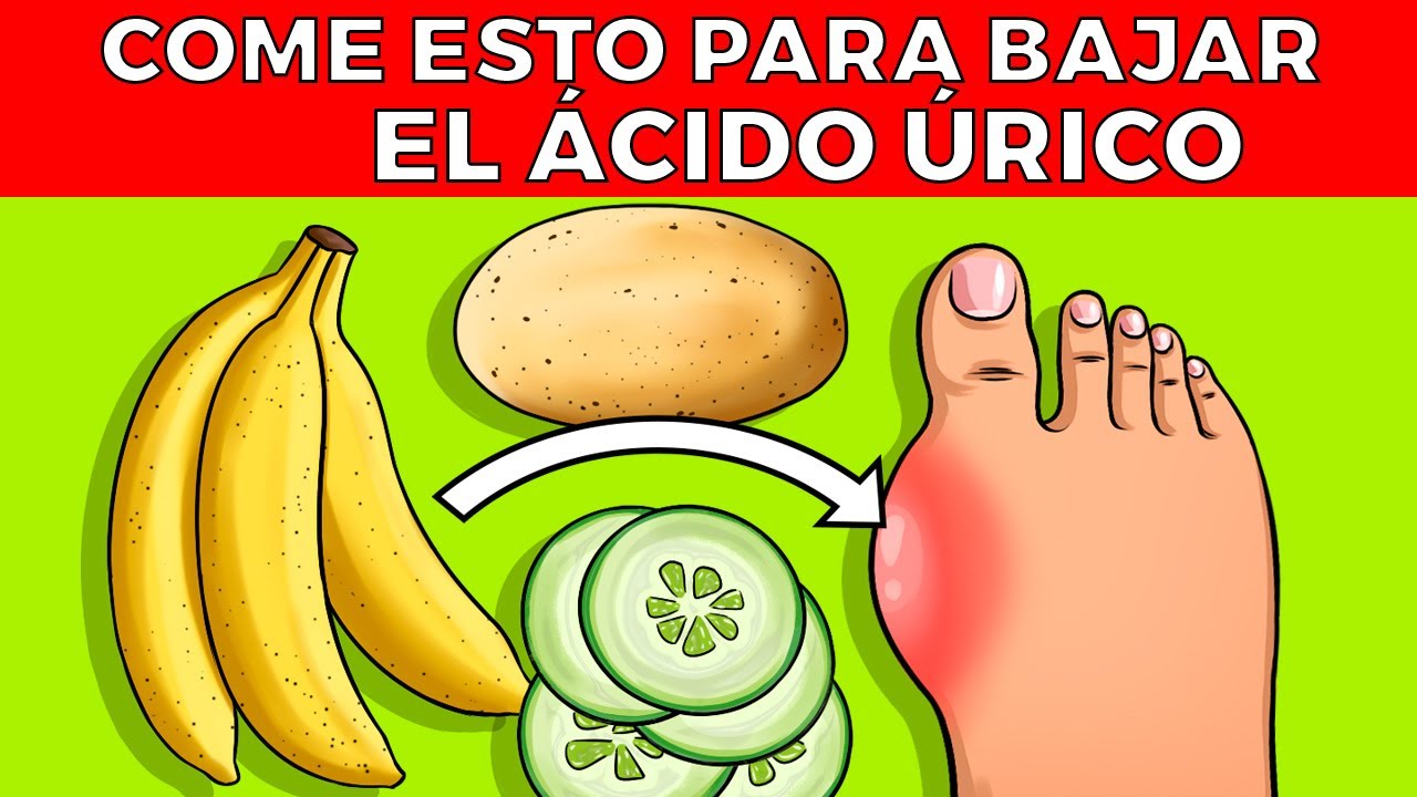 21 alimentos para BAJAR EL &Aacute;CIDO &Uacute;RICO