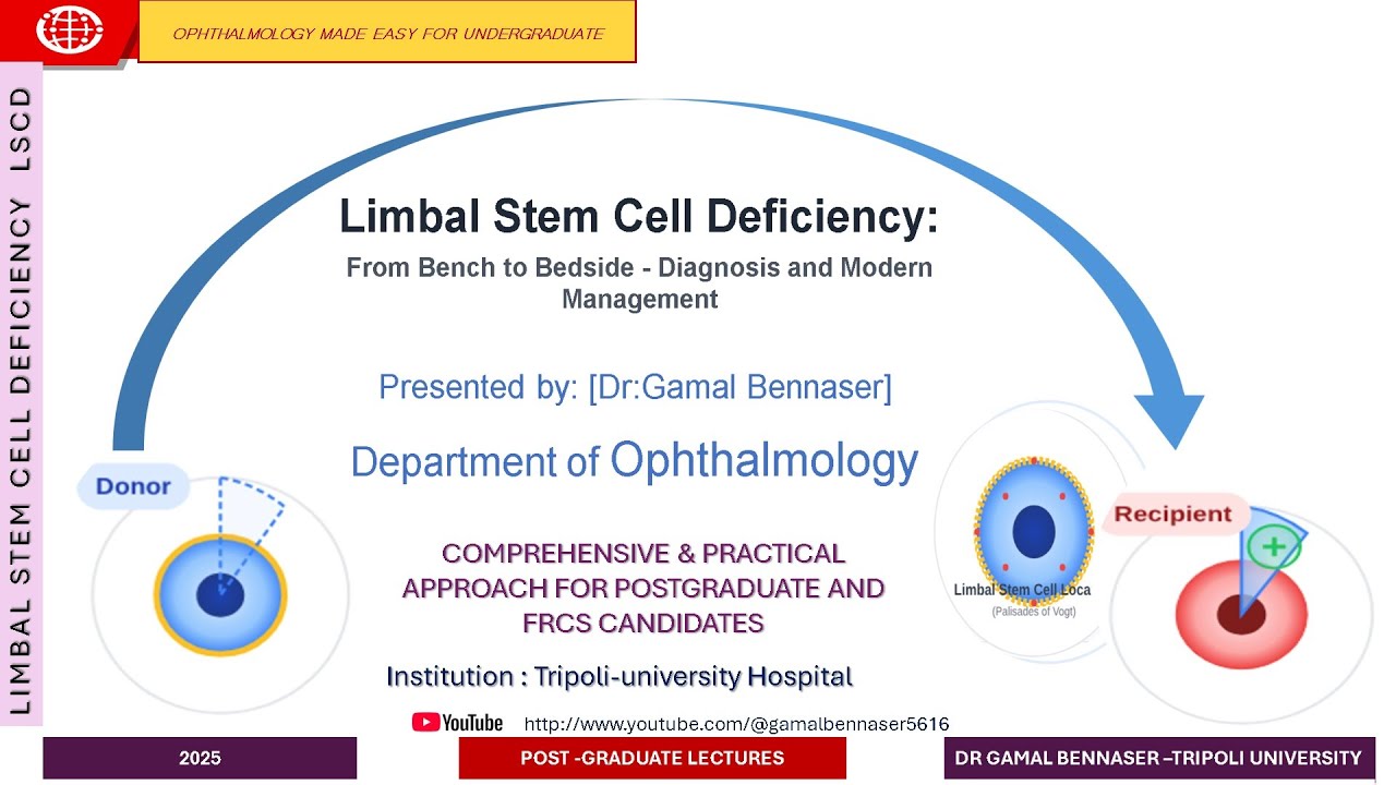 LIMBAL STEM CELL DEFICIENCY LSCD