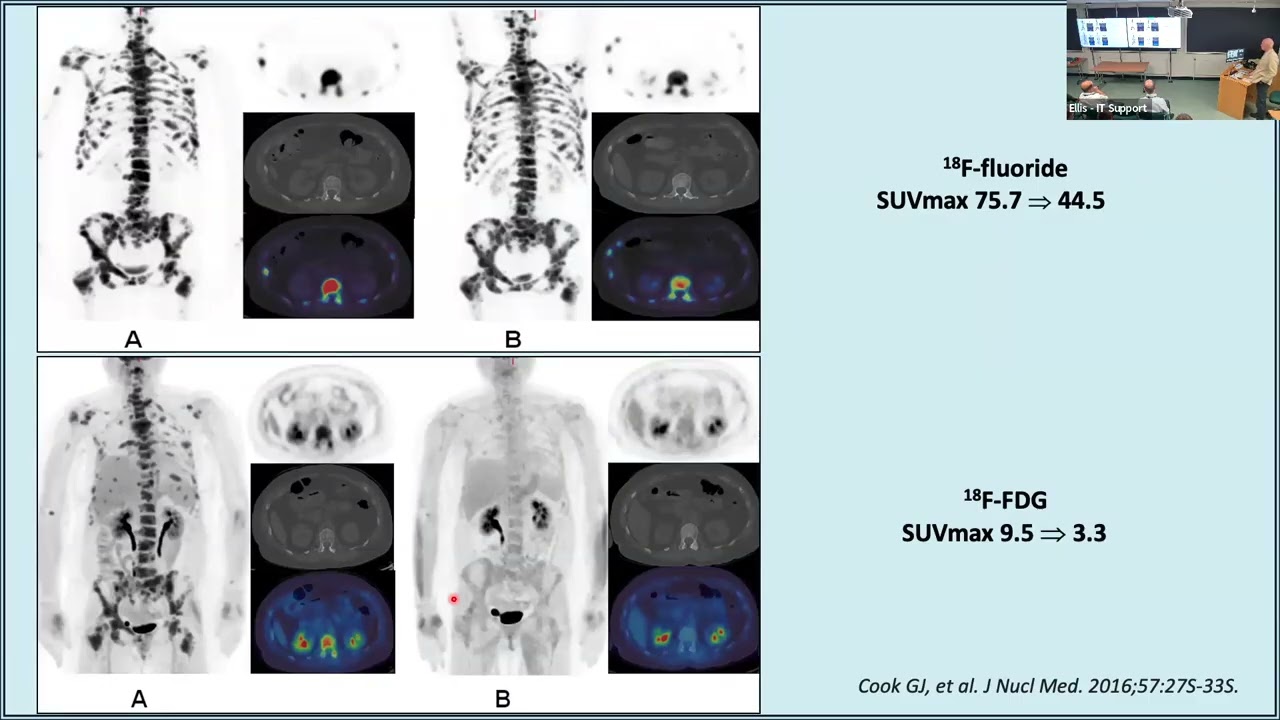 Clinical molecular imaging research at KCL/GSTT by Professor Gary Cook