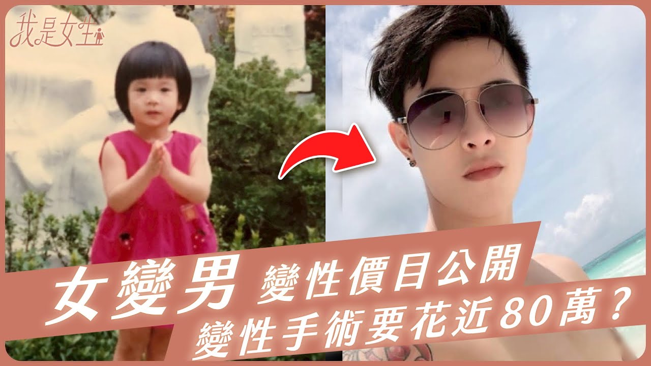【愛里】女變男變性價目表公開！變性手術要花近80萬？
