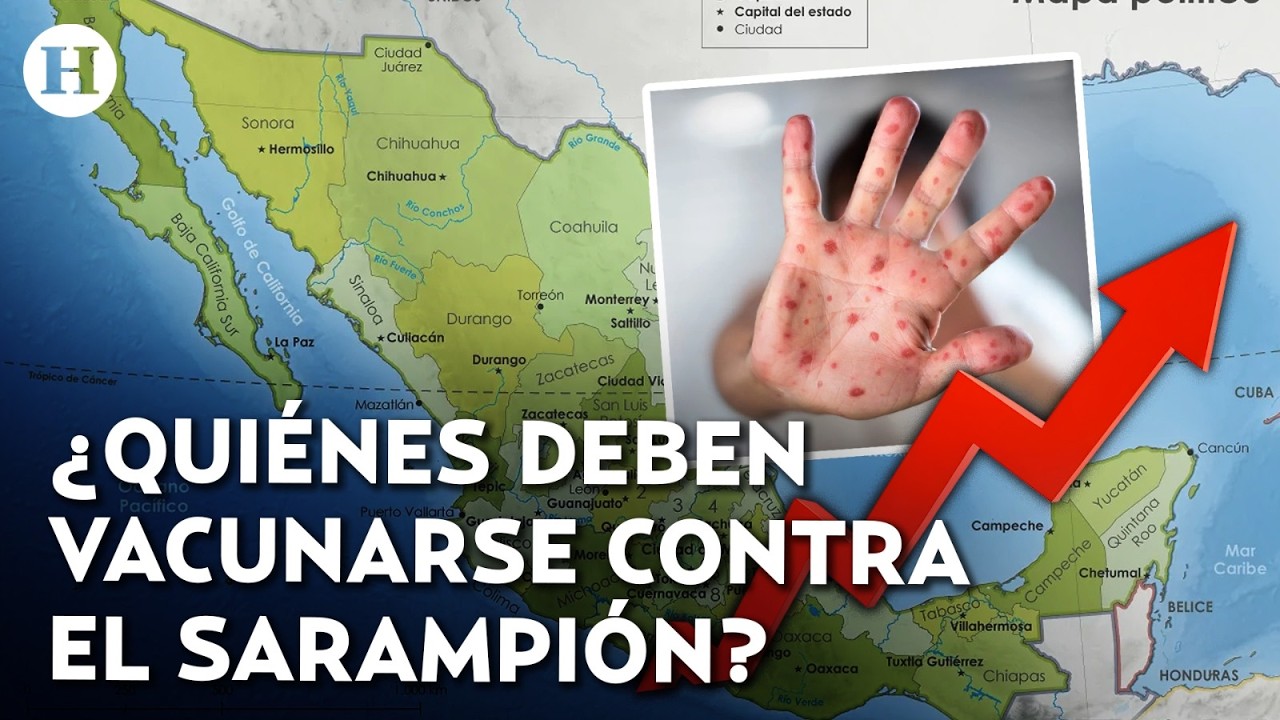 ¡Más de 8 mil casos de sarampión en México! Jalisco, CDMX y Chiapas lo estados con más contagios