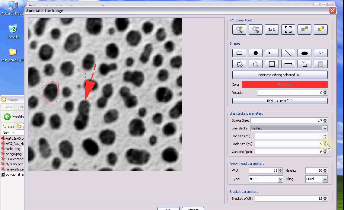 add ROIs to image