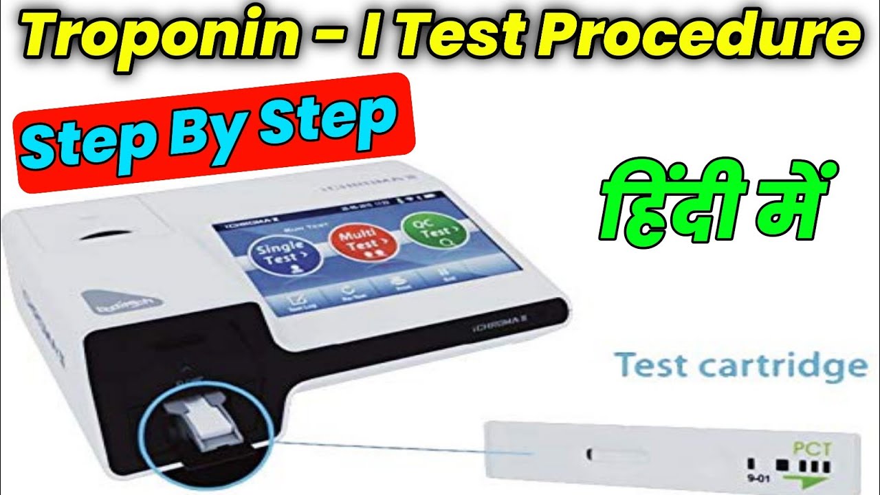 Troponin - I Test Procedure | Troponin Test Method In Hindi | Troponin Test
