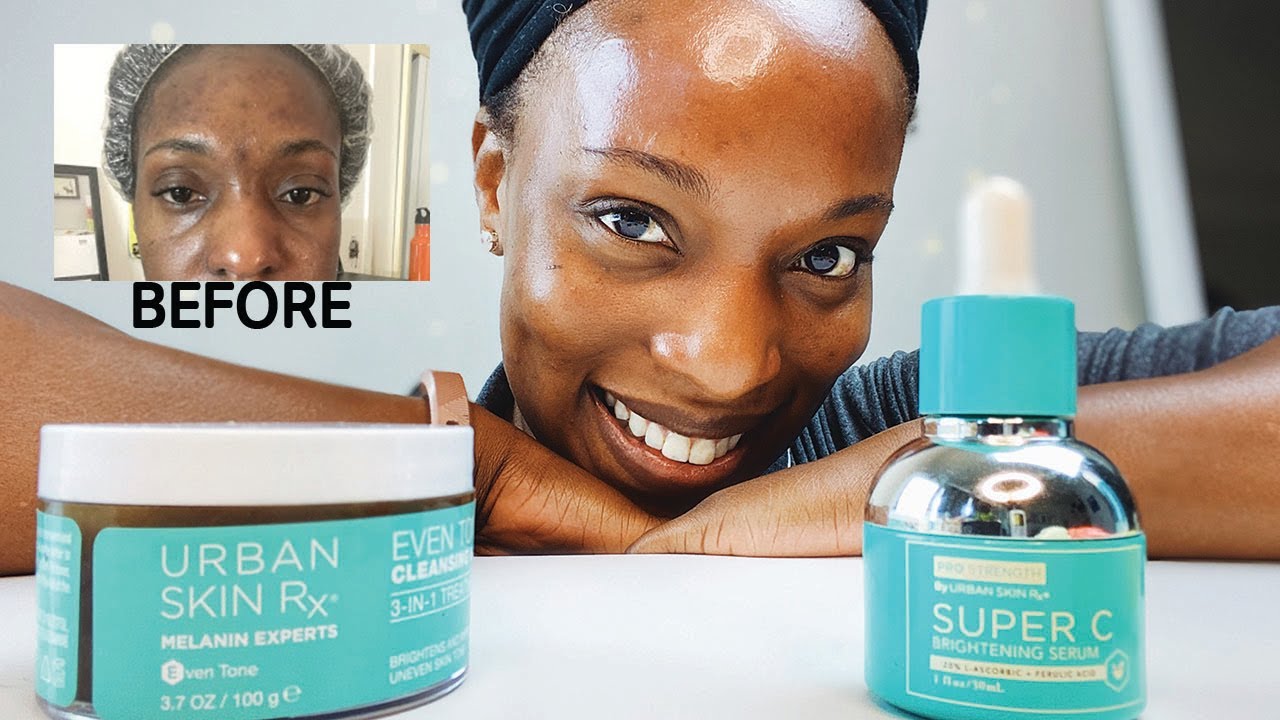 How I Cleared My Acne Bumps & Scars with Urban Skin Rx | Morning Skincare Routine