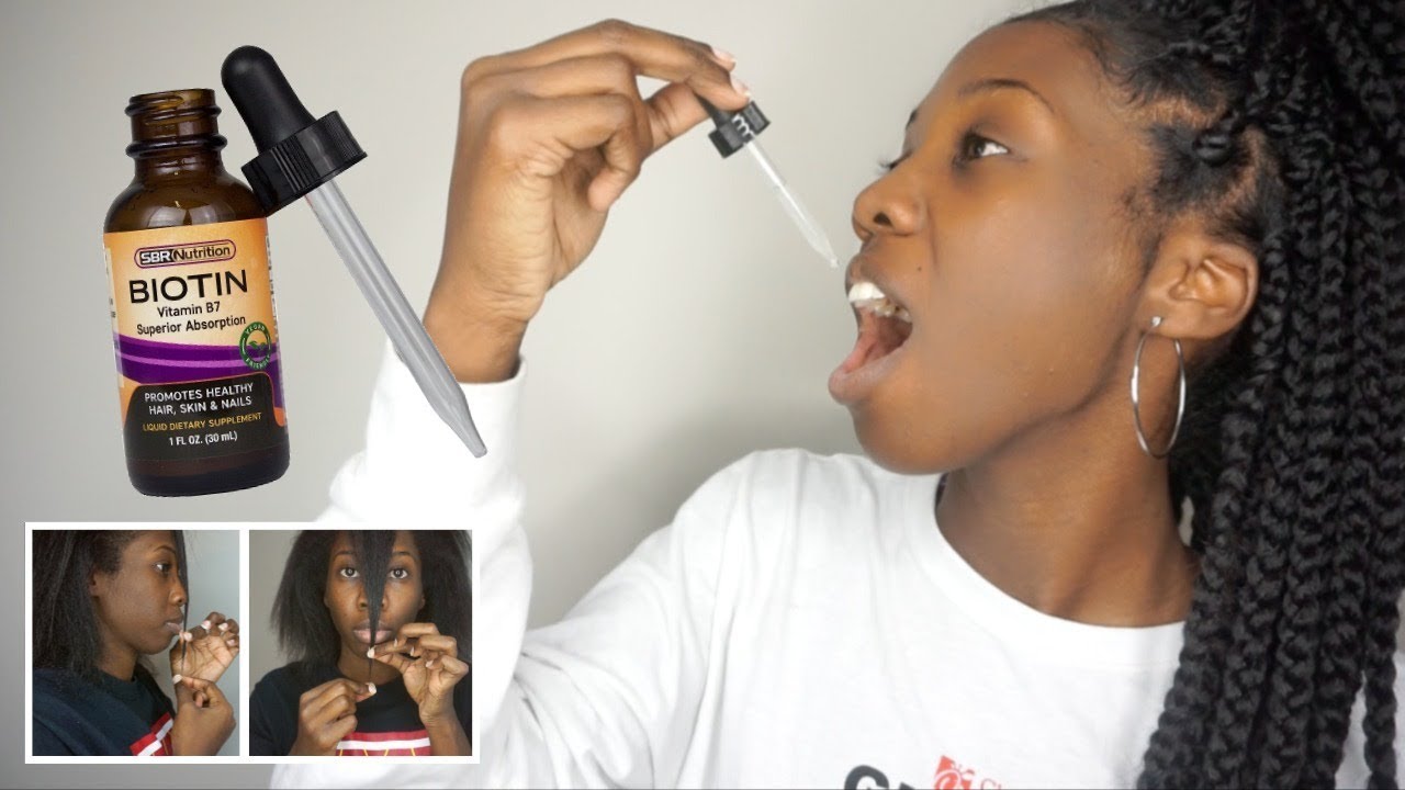 Liquid Biotin for Rapid Hair Growth! My RESULTS + EXPERIENCE after 30 DAYS!