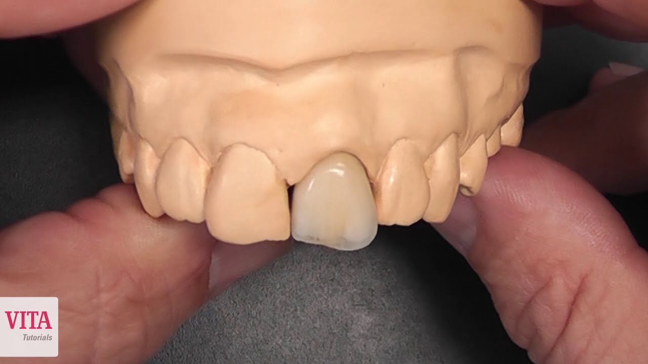 EN | Reproduction of an Anterior Crown with VITA VM LC | Individual Layering Tutorial