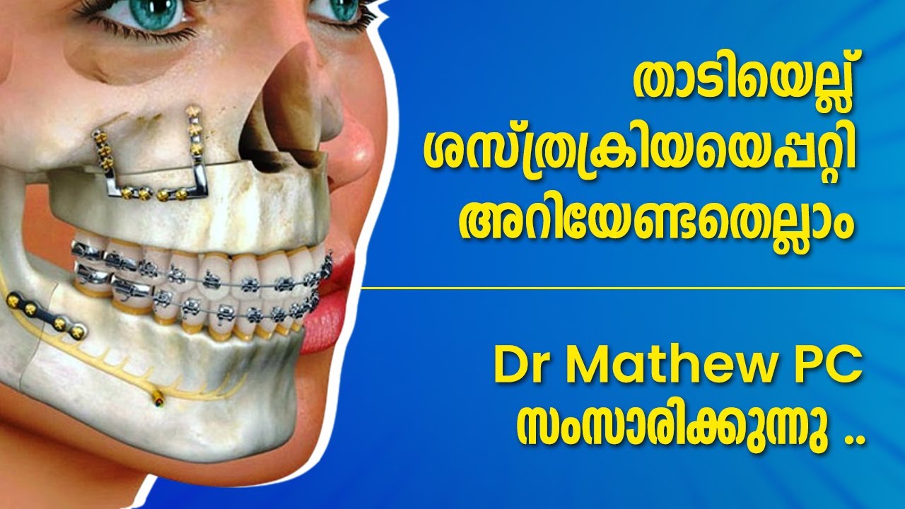 Need To Know About Jaw Surgery? |Free Online Consultation - 8330077198|Orthognathic Surgery In India