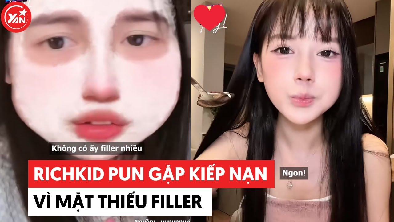 Richkid Pun gặp kiếp nạn vì mặt thiếu filler #yannews #punpun