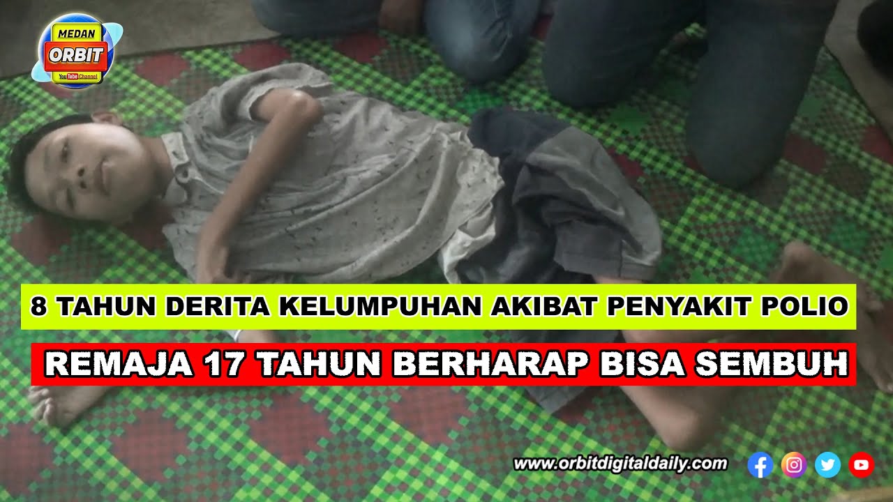8 TAHUN DERITA KELUMPUHAN AKIBAT PENYAKIT POLIO, REMAJA 17 TAHUN BERHARAP BISA SEMBUH